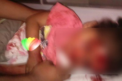 Niña herida en accidente murió