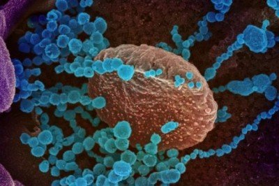 Científicos encuentran coronavirus en semen de pacientes infectados