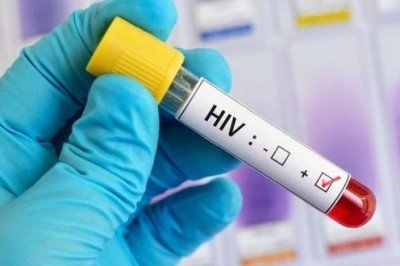 VIH desata otras enfermedades