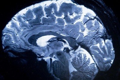 Estudio revela crecimiento constante del cerebro humano