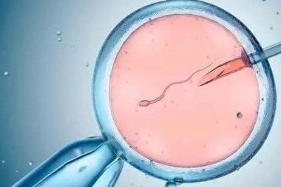 Niños nacidos por fertilización in vitro descubren que su padre biológico es un científico del laboratorio